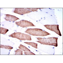 Dual Specificity Mitogen-Activated Protein Kinase Kinase 7 (MAP2K7) Antibody