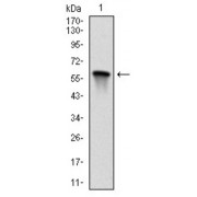 Western blot analysis using MAP2K7 antibody against human MAP2K7 (AA: 7-178) recombinant protein. (Expected MW is 45.1 kDa).