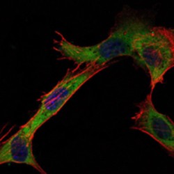 Hexokinase 1 (HK1) Antibody