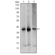 Western blot analysis using MAP2K6 antibody against HepG2 (1), MCF-7 (2) and NIH/3T3 (3) cell lysate.