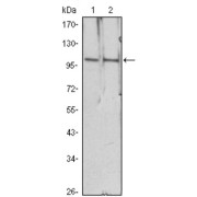Western blot analysis using HDAC4 antibody against Hela (1), Jurkat (2) cell lysate.
