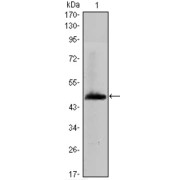 Western blot analysis using HAS1 antibody against human HAS1 (AA: 74-243) recombinant protein. (Expected MW is 44.4 kDa).