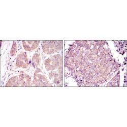 Hypoxia Inducible Factor 1 Alpha (HIF1a) Antibody