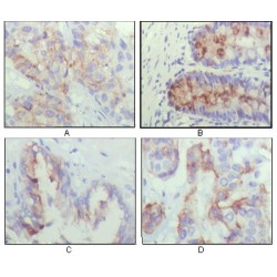 Insulin-Like Growth Factor-Binding Protein 2 (IGFBP2) Antibody