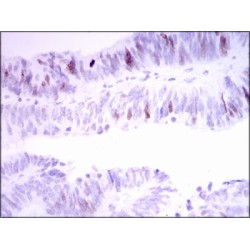 Inner Centromere Protein (INCENP) Antibody