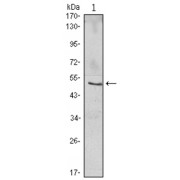 Western blot analysis using NFKBIB antibody against Jurkat (1) cell lysate.