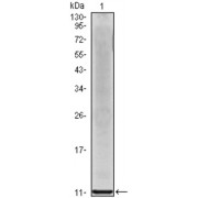 Western blot analysis using IL8 antibody against IL8 recombinant protein.