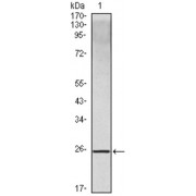 Western blot analysis using IL10 antibody against IL10 recombinant protein.