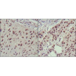 Insulin Gene Enhancer Protein ISL-1 (ISL1) Antibody