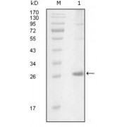 Western blot analysis using ITK antibody against truncated Trx-ITK recombinant protein (1).