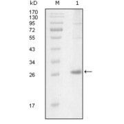 Western blot analysis using ITK antibody against truncated Trx-ITK recombinant protein (1).