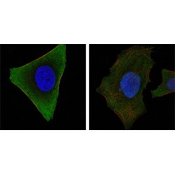 Tyrosine-Protein Kinase JAK3 (JAK3) Antibody
