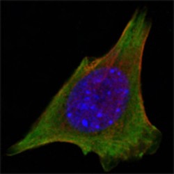 Tyrosine-Protein Kinase JAK3 (JAK3) Antibody