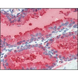PSA (KLK3) Antibody