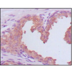 PSA (KLK3) Antibody