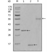 Western blot analysis using Ki67 antibody against truncated Trx-Ki67 recombinant protein (1),truncated Ki67 (aa3118-3256) -His recombinant protein (2) and truncated Ki67 (aa3118-3256) -hIgGFc transfected CHO-K1 cell lysate (3).