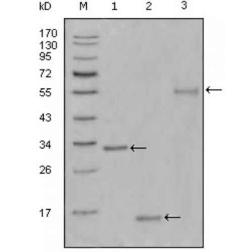 Proliferation Marker Protein Ki 67