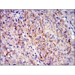 Mast/Stem Cell Growth Factor Receptor Kit (KIT) Antibody