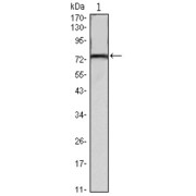 Western blot analysis using KLHL22 antibody against mouse brain tissues lysate.