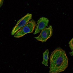 Mammaglobin-A (SCGB2A2) Antibody