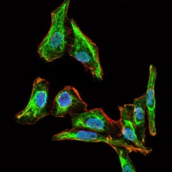 Maternal Embryonic Leucine Zipper Kinase (MELK) Antibody