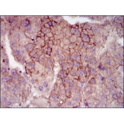 Maternal Embryonic Leucine Zipper Kinase (MELK) Antibody