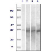 Western blot analysis using Rab25 antibody against truncated Rab25 recombinant protein (1), human overy carcinoma (2), stomach carcinoma (3), breast carcinoma (4) tissue lysate.