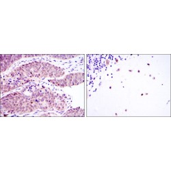 RNA-Binding Protein Musashi Homolog 2 (MSI2) Antibody