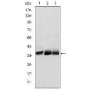Western blot analysis using MSI2 antibody against NTERA-2 (1), SW620 (2) and T47D (3) cell lysate.