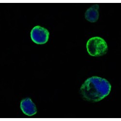 Muscle Skeletal Receptor Tyrosine Kinase (MUSK) Antibody