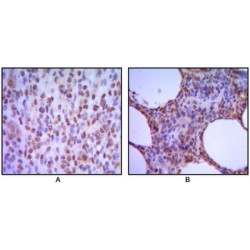 PWWP Domain-Containing Protein MUM1 (MUM1) Antibody