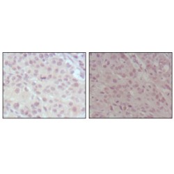 Myeloid/lymphoid Or Mixed-Lineage Leukemia (MLL) Antibody
