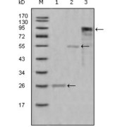 Western blot analysis using MPO antibody against truncated Trx-MPO recombinant protein (1),truncated MBP-MPO (aa1-193) recombinant protein (2) and truncated MPO (aa165-745) -hIgGFc transfected CHO-K1 cell lysate (3).