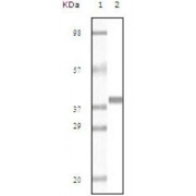 Western blot analysis using Myoglobin antibody against truncated Myoglobin recombinant protein (AA: 2-154).