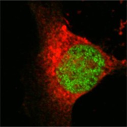 Histone Acetyltransferase KAT8 (MYST1) Antibody