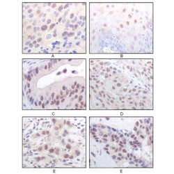 Histone Acetyltransferase KAT8 (MYST1) Antibody