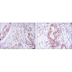 Nucleus Accumbens Associated 1 (NACC1) Antibody