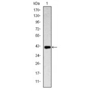 Western blot analysis using CD94 antibody against human CD94 (AA: 32-179) recombinant protein. (Expected MW is 42.6 kDa).