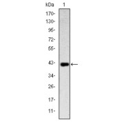 Western blot analysis using CD94 antibody against human CD94 (AA: 32-179) recombinant protein. (Expected MW is 42.6 kDa).