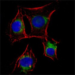 Nerve Growth Factor Receptor (NGFR) Antibody