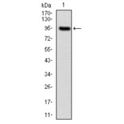 Western blot analysis using NEFL antibody against human NEFL (AA: 422-543) recombinant protein. (Expected MW is 62 kDa).