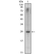 Western blot analysis using NKX3A antibody against LNCaP (1) cell lysate.