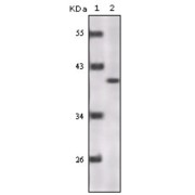 Western blot analysis using P16 antibody against truncated P16 recombinant protein.