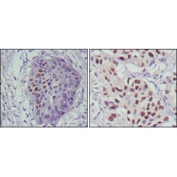 Cellular Tumor Antigen P53 (p53) Antibody