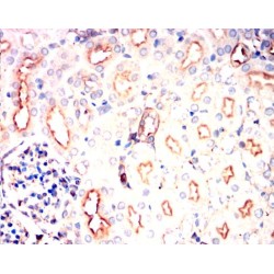 Phosphatidylinositol-4,5-Bisphosphate 3-Kinase Catalytic Subunit Alpha Isoform (PIK3CA) Antibody