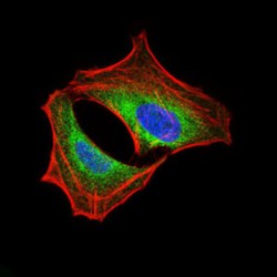 Phosphatidylinositol 3-Kinase Regulatory Subunit Alpha (PIK3R1) Antibody