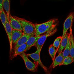 Phosphatidylinositol 3-Kinase Regulatory Subunit Alpha (PIK3R1) Antibody