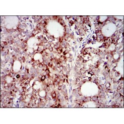 Phosphatidylinositol 3-Kinase Regulatory Subunit Alpha (PIK3R1) Antibody