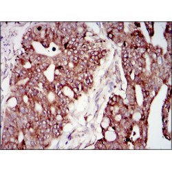 Phosphatidylinositol 3-Kinase Regulatory Subunit Alpha (PIK3R1) Antibody