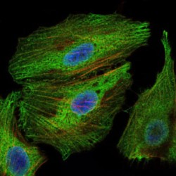 Lymphokine-Activated Killer T-Cell-Originated Protein Kinase (PBK) Antibody